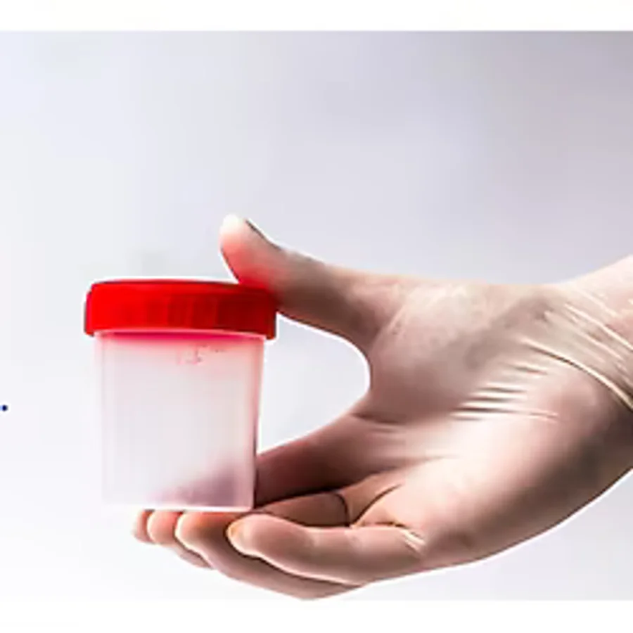 Aklab Group Düz Idrar Kabı 100 ml Non Steril 50 Adet