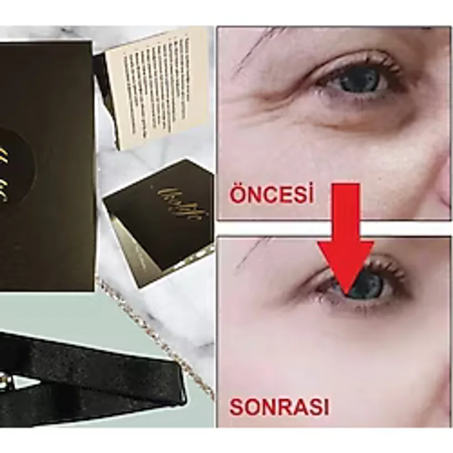 Akolife Yüz Germe Bant Aparat