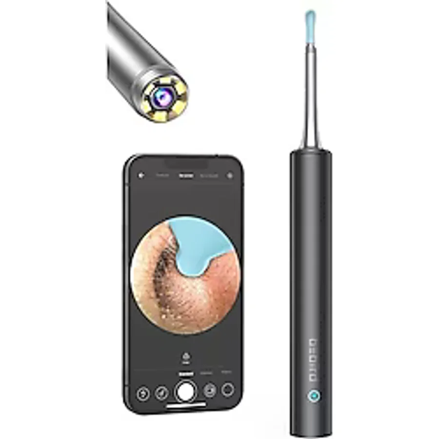 Bebird T5 3MP Kamera Siyah Şarjlı Kulak Temizleme Aleti