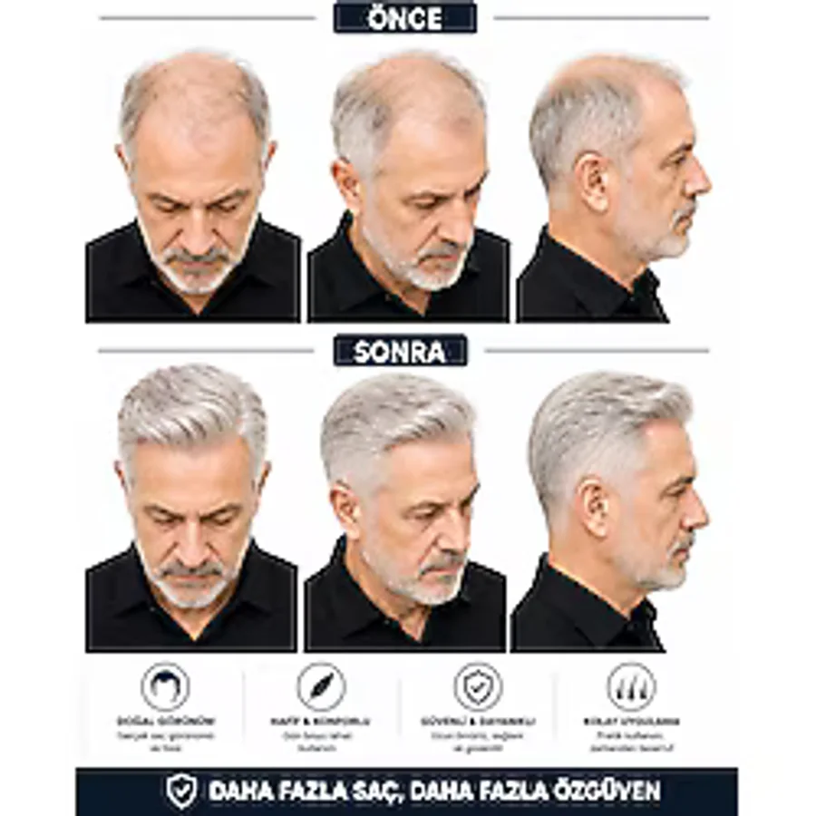 Hairtime Erkek Beyaz Protez Saç - Doğal Görünümlü, Hafif ve Konforlu Saç Sistemi