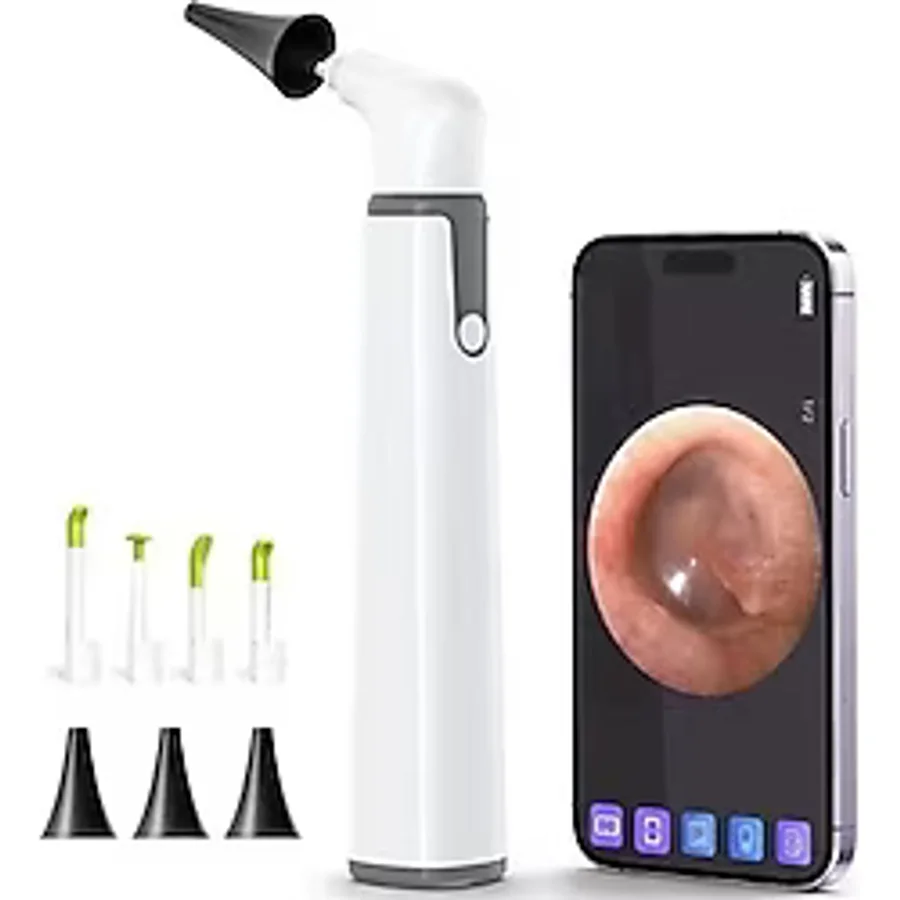 Scopearound Otoskop, Kulak Kiri Temizleme Aleti İle Birlikte - 3.9 Mm