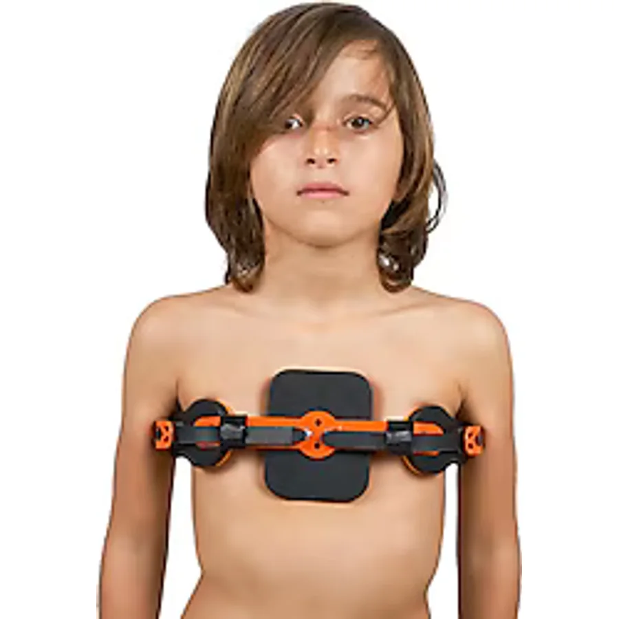 Wingmed WP953 Pectus Carinatum Ortezi